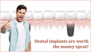 Dental Implants are worth the money spent