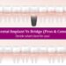 Dental Implants Vs Dental Bridges