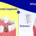 Dental Implants or Veneers – Exploring The Pros and Cons - perfect