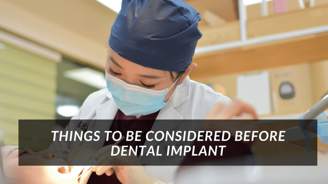 Things to be considerd before Dental implant