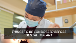 Things to be considerd before Dental implant