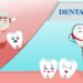 Top 5 Benefits of Dental Implants