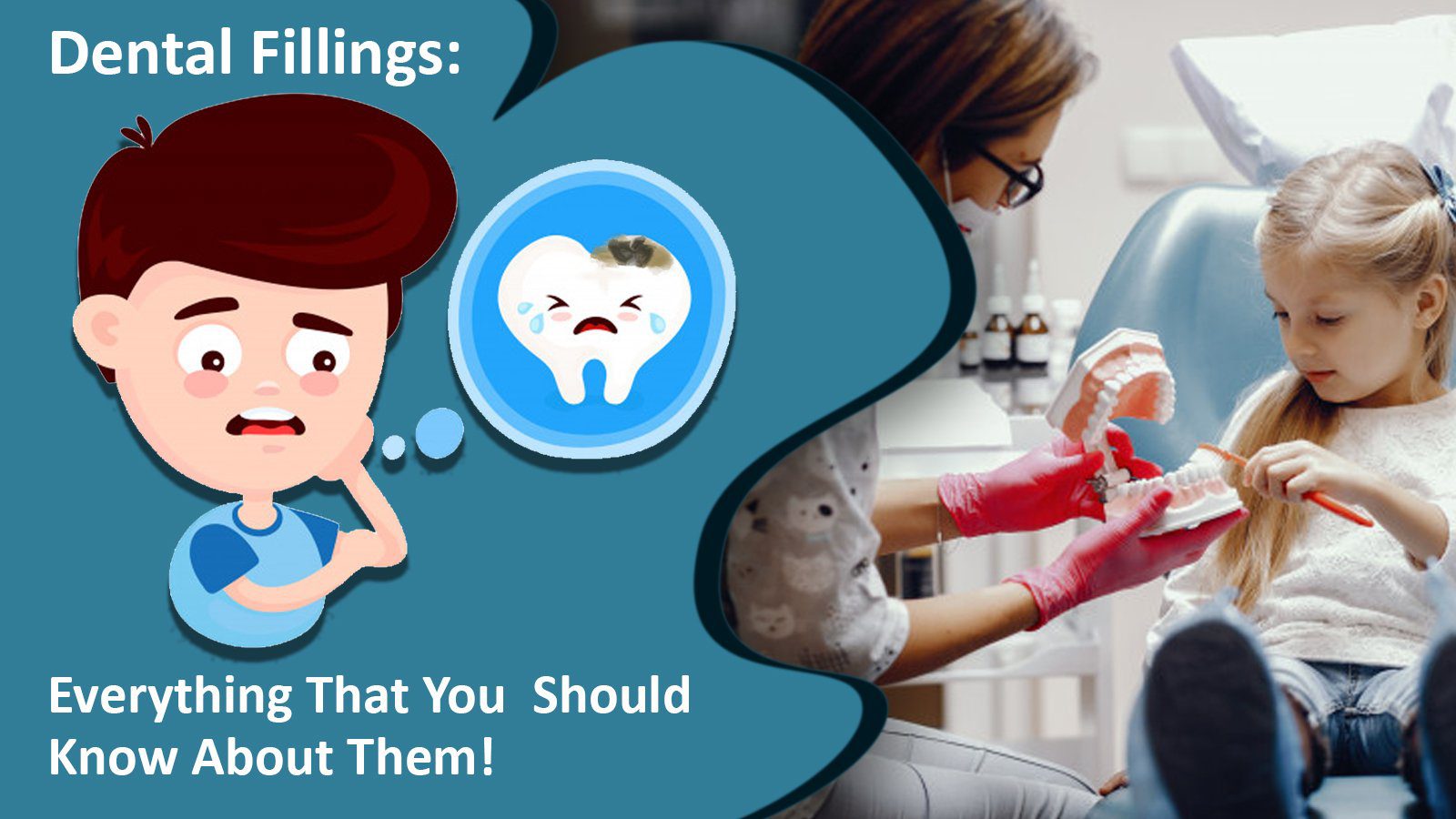 Dental Fillings Everything That You Should Know About Them!