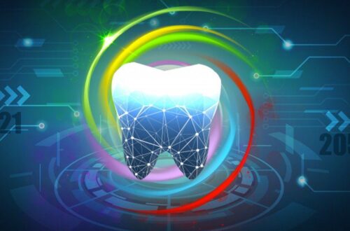 Latest Innovations in the Dental Implant Technology