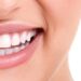 Invisalign as an Aspiring Model - Invisalign vs braces