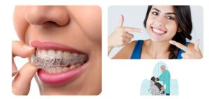 An Introduction To Invisalign In 5 Minutes- Invisalign -Invisalign orthodontist