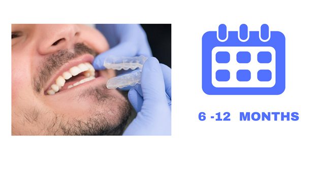 Invisalign - Invisalign aligners