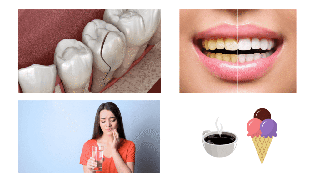 Cracked Teeth, Discoloured Teeth, Heightened sensitivity to taste