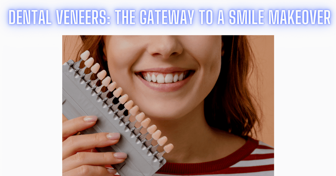 Dental Veneers The Gateway To A Smile Makeover