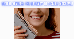 Dental Veneers The Gateway To A Smile Makeover