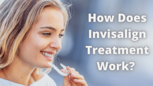 How Does Invisalign Treatment Work - Invisalign Treatment