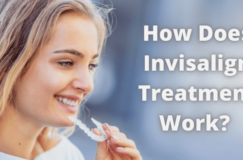 How Does Invisalign Treatment Work - Invisalign Treatment