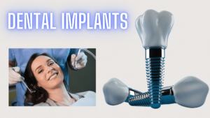 Dental Implants Procedure - Dental Implant cost Australia