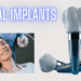 Dental Implants Procedure - Dental Implant cost Australia