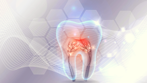 What Is Enamel Loss And How May It Be Treated