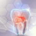What Is Enamel Loss And How May It Be Treated