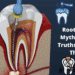 7 Root Canal Myths and the Truths Behind Them