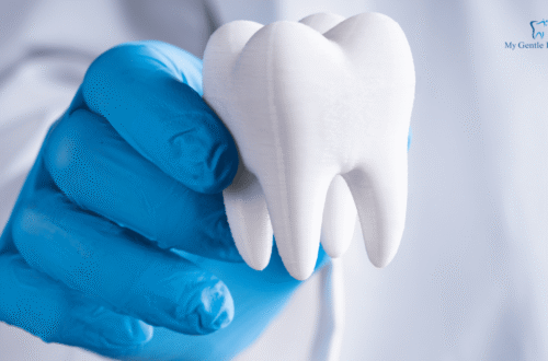 5 Best Tooth Replacement Options for When You Lose a Tooth