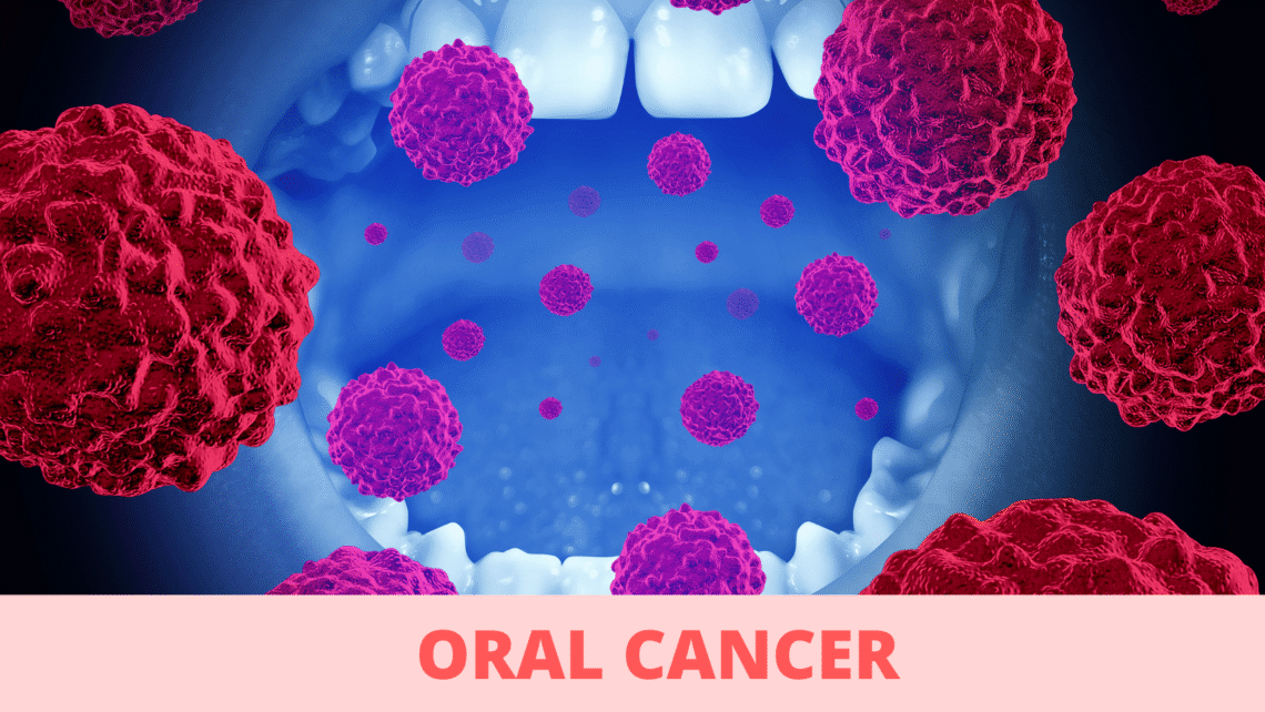 Oral Cancer: The Symptoms You Need to Know, and How to Prevent It