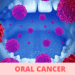 Oral Cancer: The Symptoms You Need to Know, and How to Prevent It