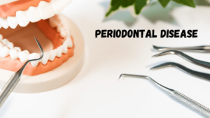 Prevention of Periodontal Disease