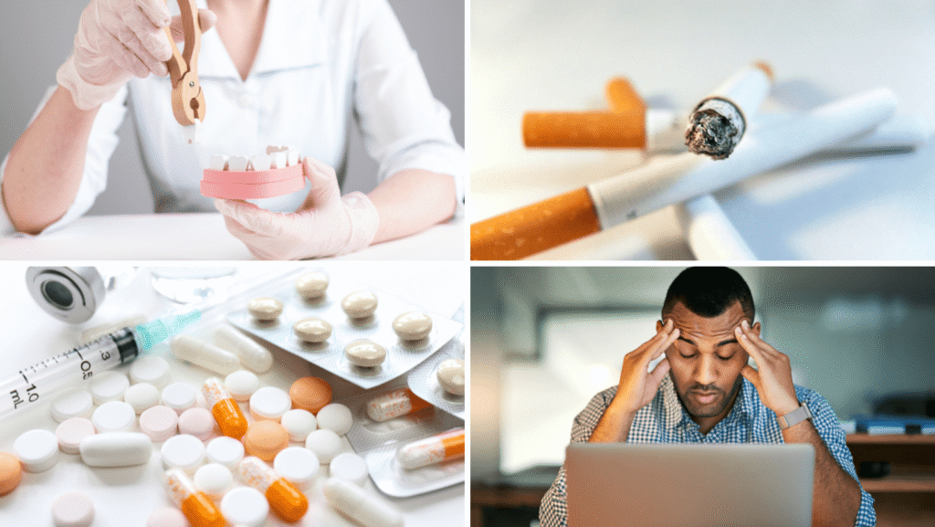 What are signs of severe Gum Disease?
