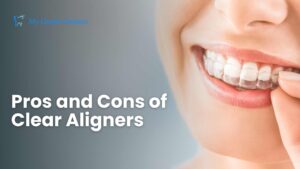 Clear Aligners