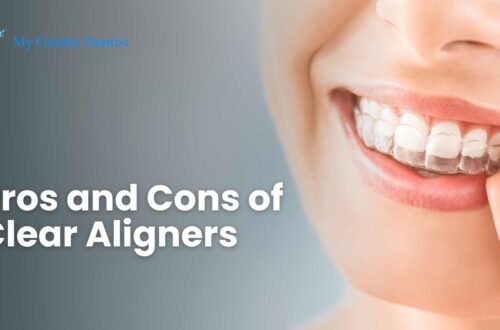 Clear Aligners