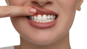 Dental Emergency