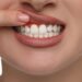 Dental Emergency
