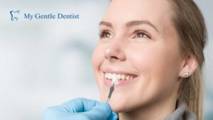 Veneers