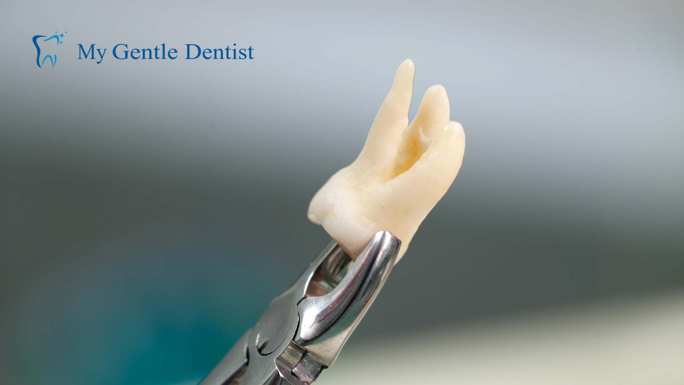 Wisdom Tooth Extraction