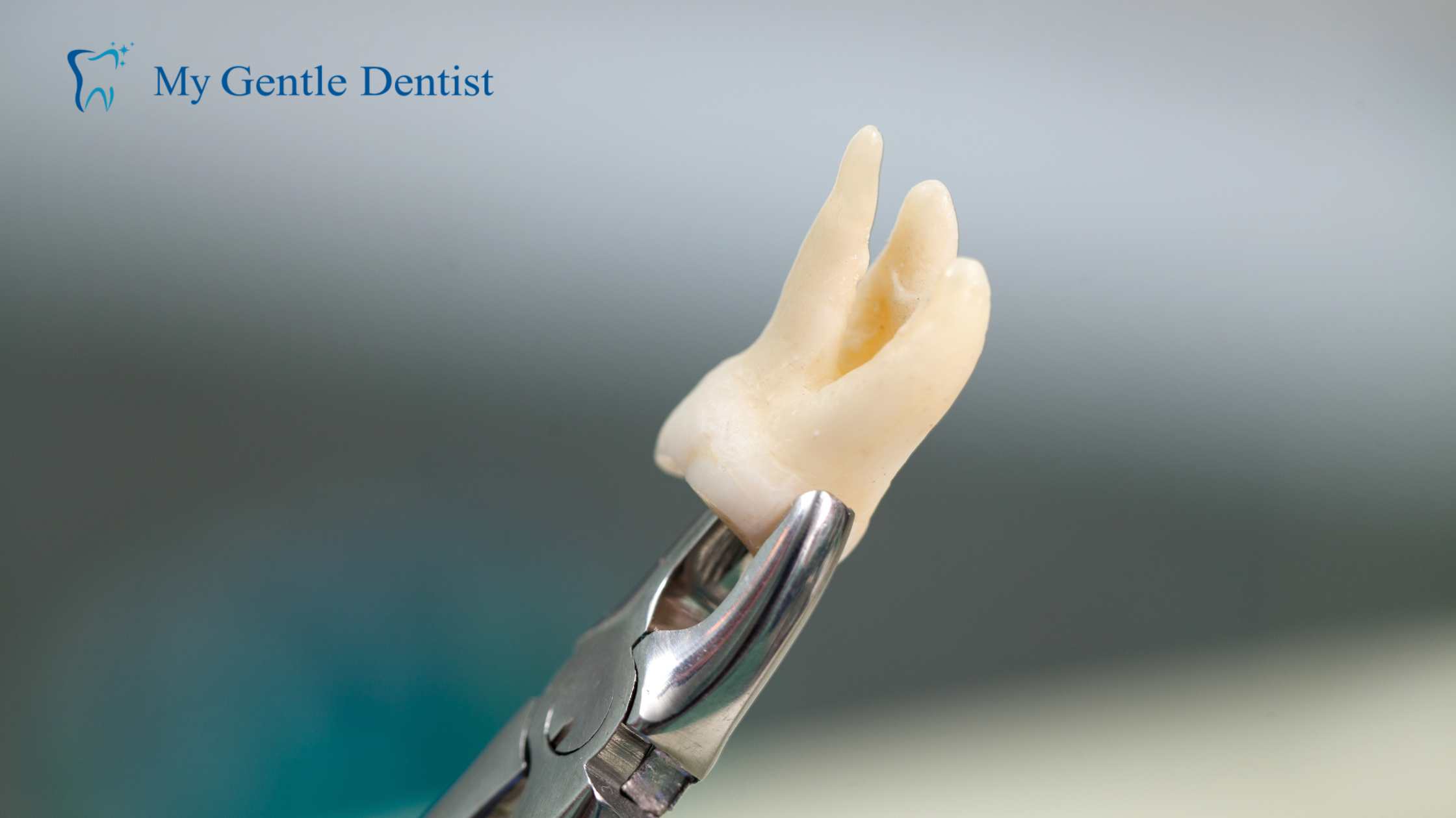 Wisdom Tooth Removal