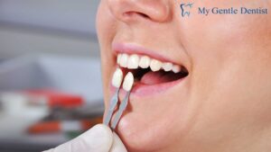 Porcelain Veneers