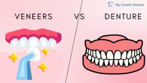 Veneers vs. Dentures