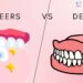 Veneers vs. Dentures