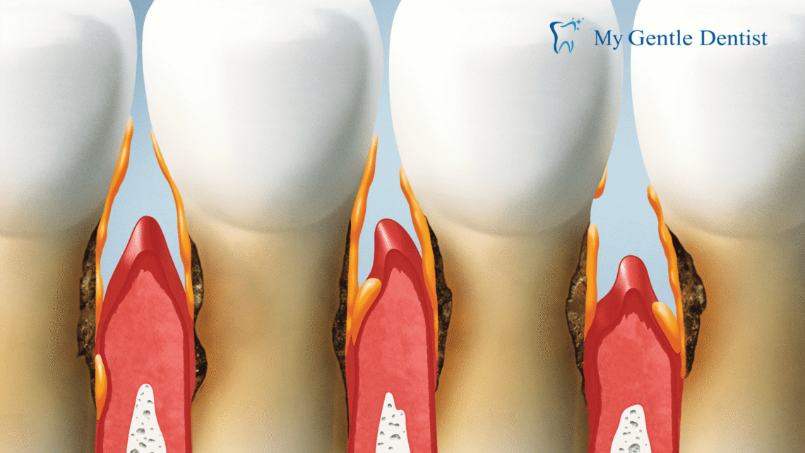 Periodontists Treatments