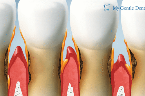 Periodontists Treatments