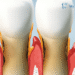 Periodontists Treatments