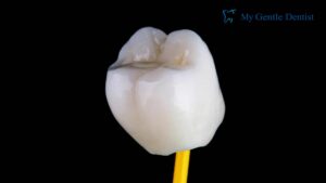 Dental Crown