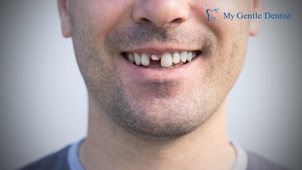Damaged Teeth