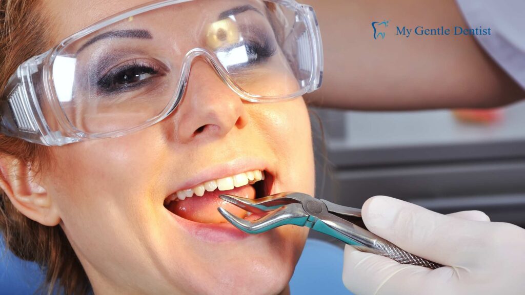 Benefits of Tooth Extraction