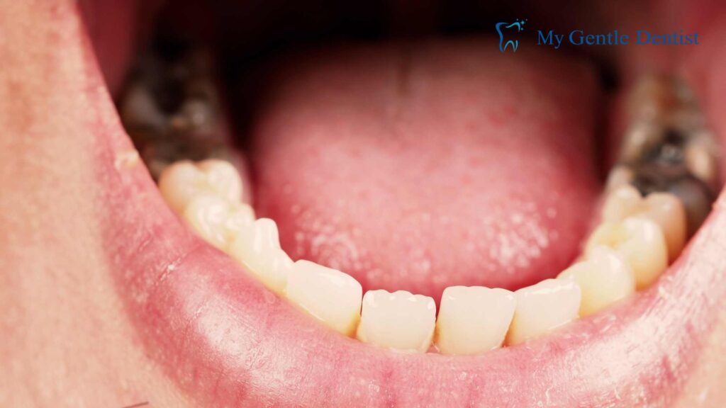 Dental treatment