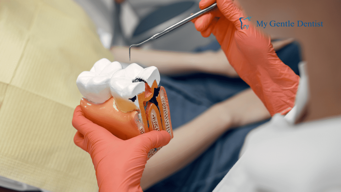 Root Canal