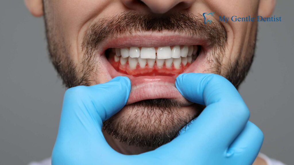 Red or Swollen Gums