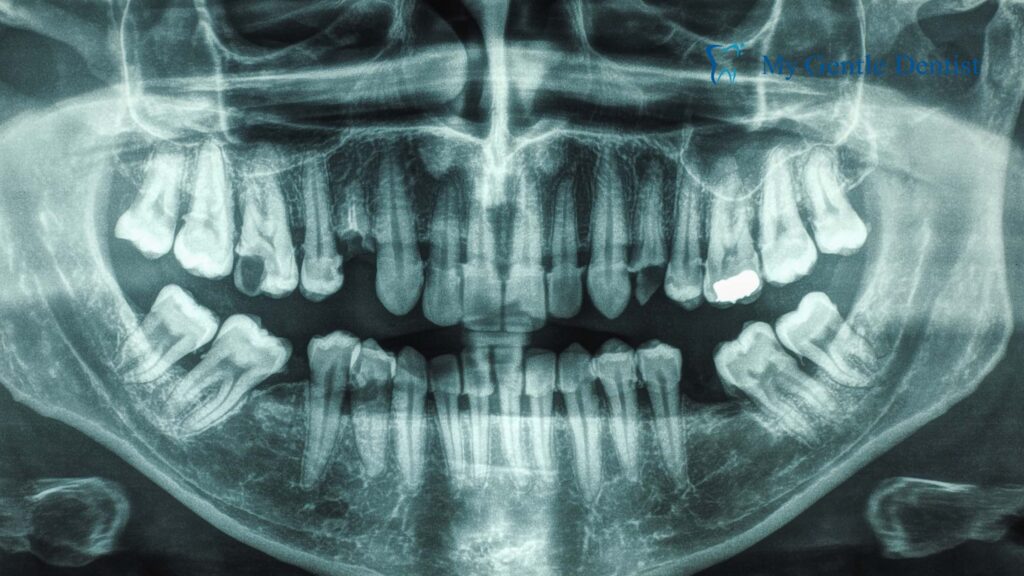 Jaw Bone Health