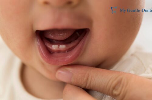 Baby Teeth