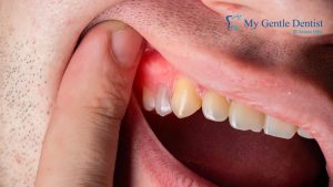 Dentists in Mitchelton