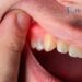 Dentists in Mitchelton