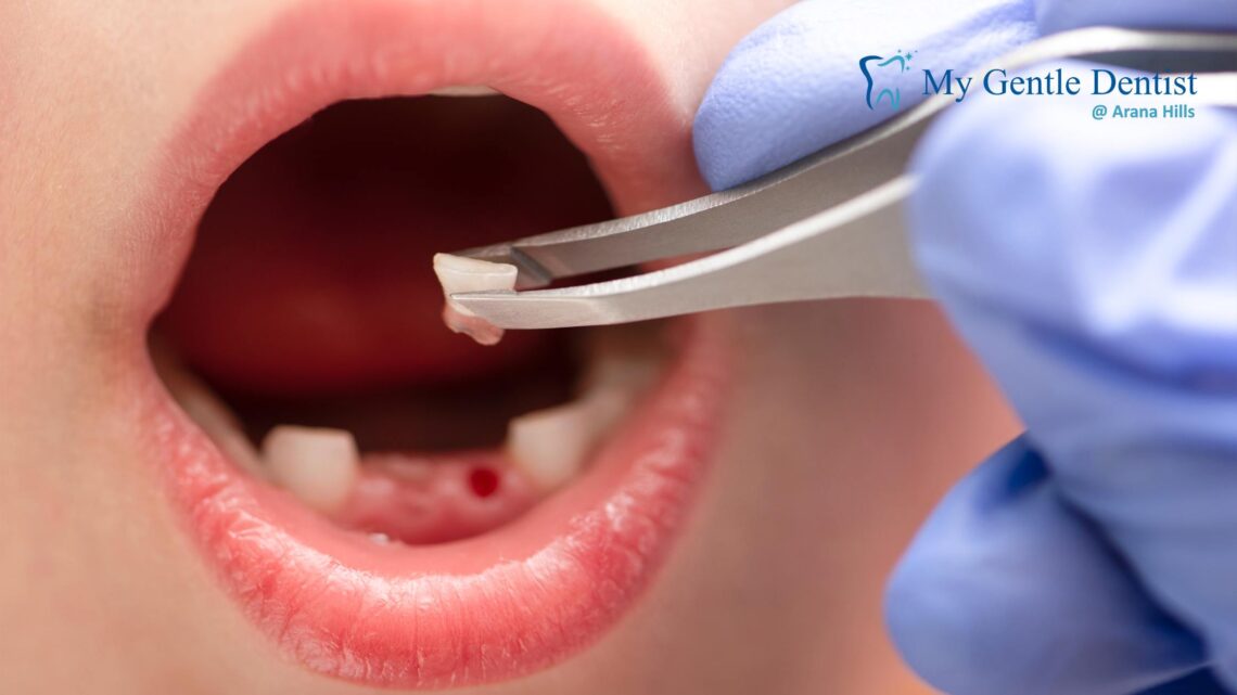knocked-out tooth